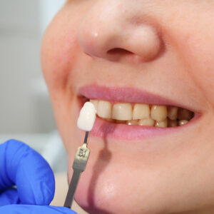 Getting a Dental Crown? Here’s What You Can Expect