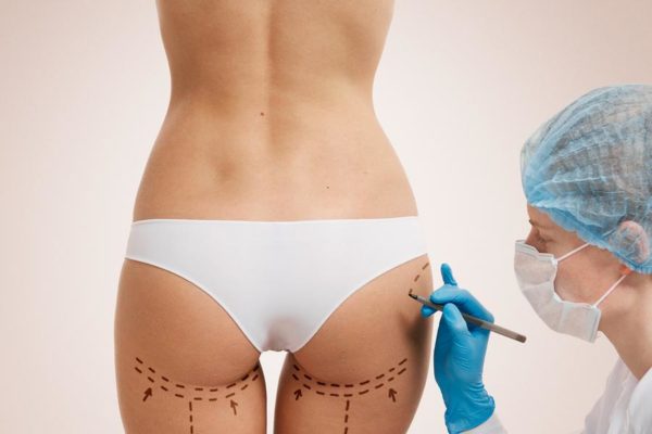 Would You Have Cheap Plastic Surgery Done Overseas?