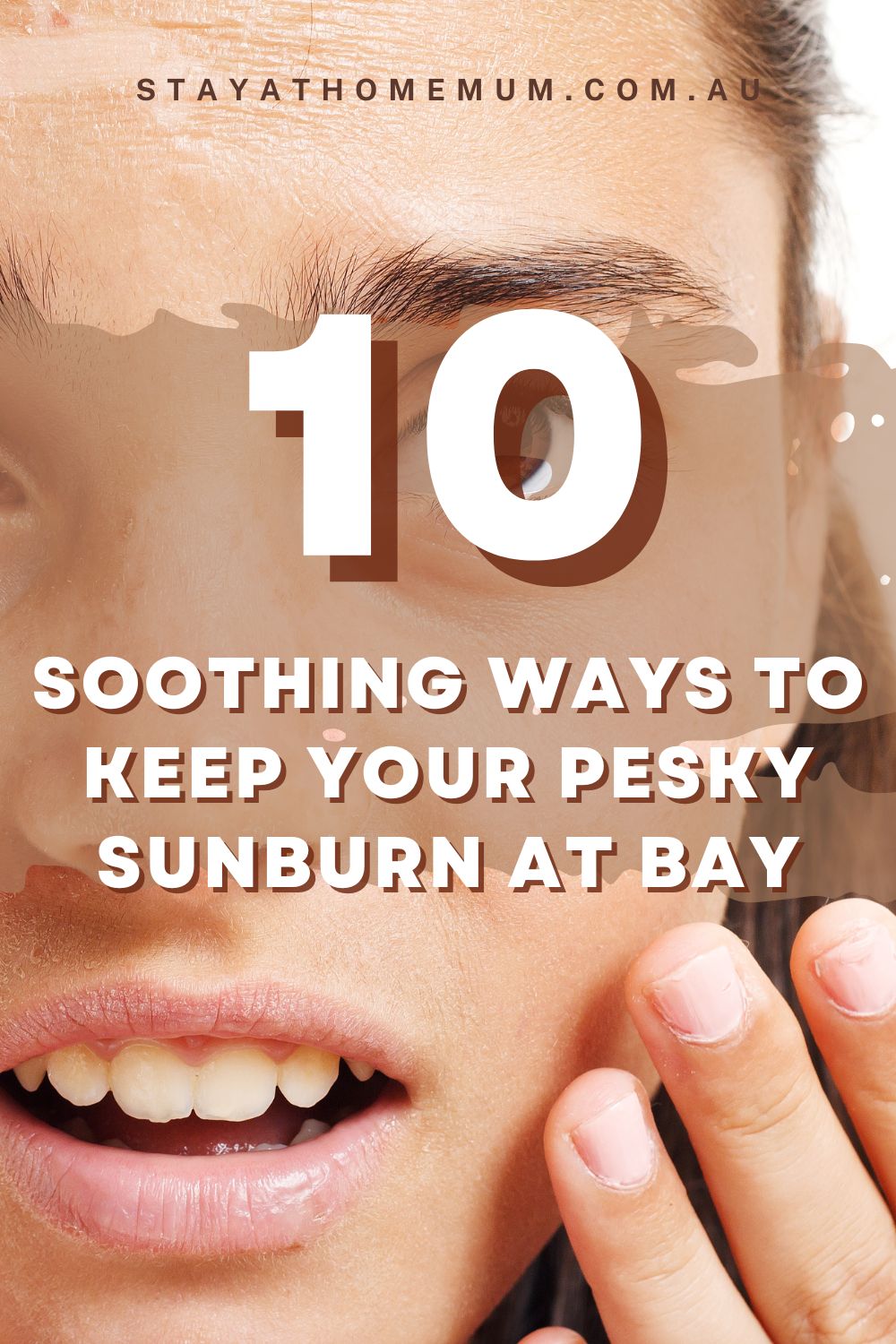 10 Soothing Ways To Keep Your Pesky Sunburn At Bay I Stay at Home Mum