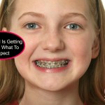 My child is getting braces what to expect11 | Stay at Home Mum.com.au
