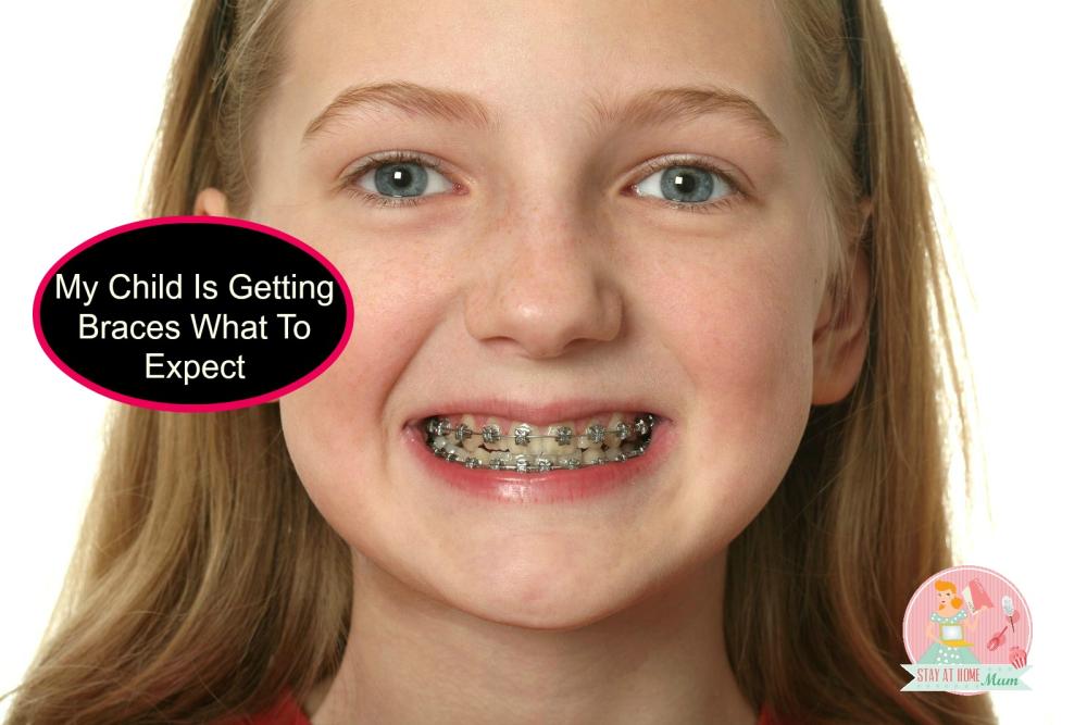 What To Expect When Your Child Gets Braces