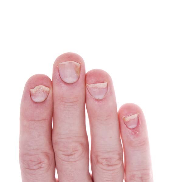 Are Your Nails Trying To Tell You Something?