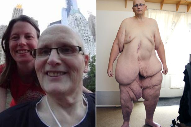Heaviest People On Earth Break All The Wrong Records | Stay At Home Mum