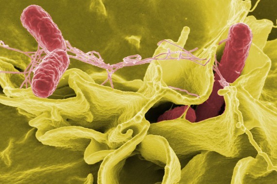 Everything You Need To Know About Salmonella Poisoning