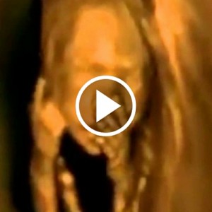 Unborn Baby Dances and Waves in 4D Ultrasound
