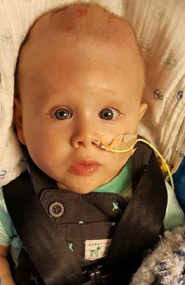 Baby Boy Born with Brain Outside His Skull Defies Odds Living Past Birth | Stay at Home Mum