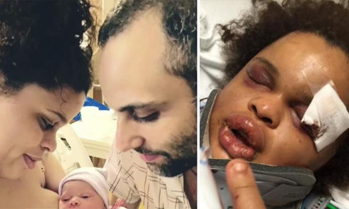 Wife Beaten By Husband Just Weeks After Giving Birth