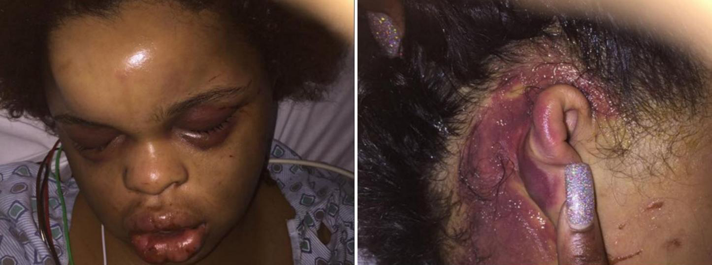 Wife Beaten By Husband Just Weeks After Giving Birth | Stay at Home Mum