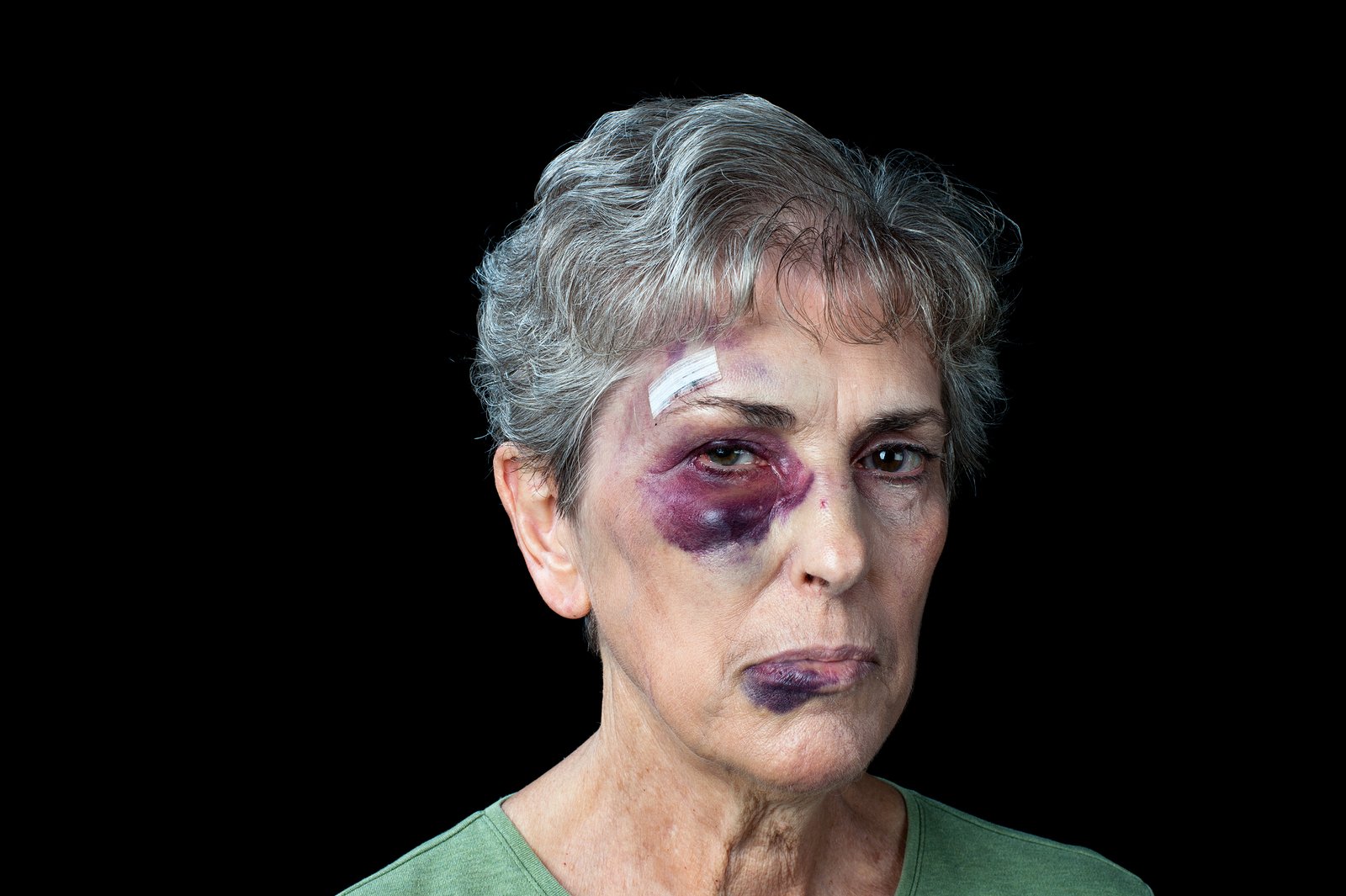 An elderly grandmother badly beaten with stitches, a black eye and a fat lip.