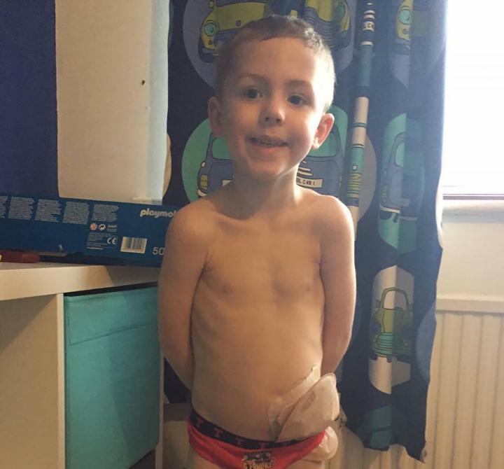 Boy Has "Poo Phobia" That He Didn't Poo for Four Months | Stay at Home Mum