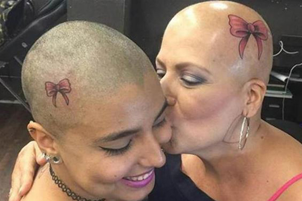 Mum and Daughter Get Matching Tattoo on Scalp in Fight Against Breast Cancer