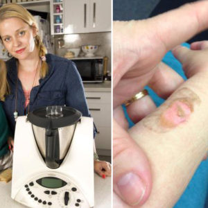 ACCC Launches Investigation Over Thermomix Explosions