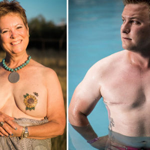 Woman Who Had Preemptive Mastectomy Creates Book About Breast Cancer Survivors
