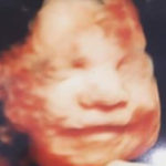 4D Scan Shows Baby Girl Smiling At The Sound Of Her Sister's Voice | Stay at Home Mum