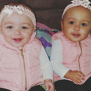Rare Biracial Twins Born With Different Skin Colours