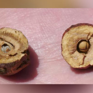 Doctor Slams Using Wasp Nest Calling It A ‘Dangerous’ Vaginal Trend