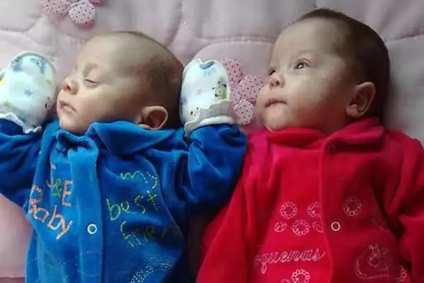 Pregnant Mother Kept Alive For 123 Days Until Her ‘Miracle’ Twins Were Delivered