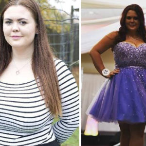 Mum Whose Breasts Won’t Stop Growing Makes Desperate Plea For Breast Reduction Surgery
