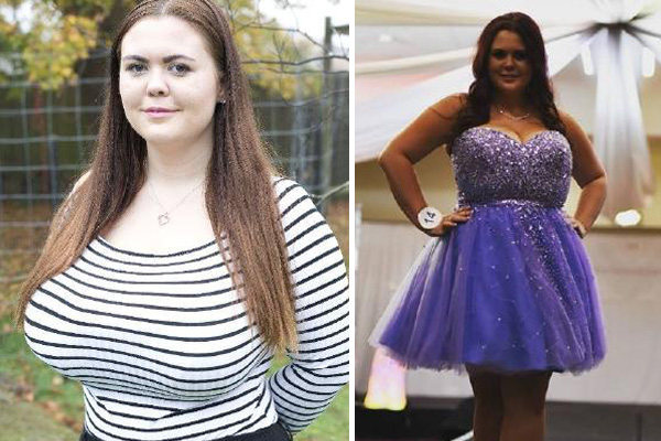 Mum Whose Breasts Won’t Stop Growing Makes Desperate Plea For Breast Reduction Surgery