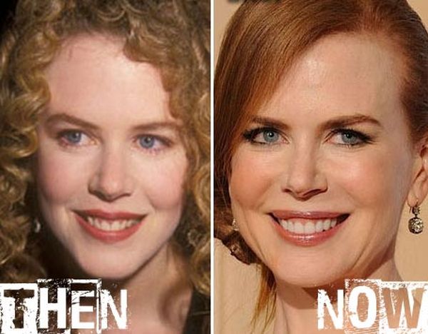 The 5 Best and 5 Worst of Hollywood Cosmetic Surgery | Stay At Home Mum
