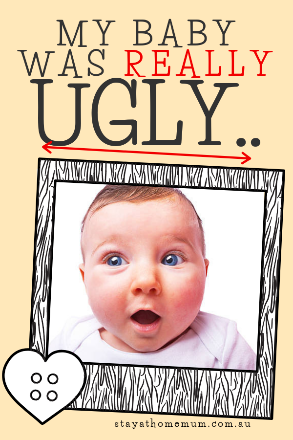My Baby Was Really Ugly | Stay At Home Mum