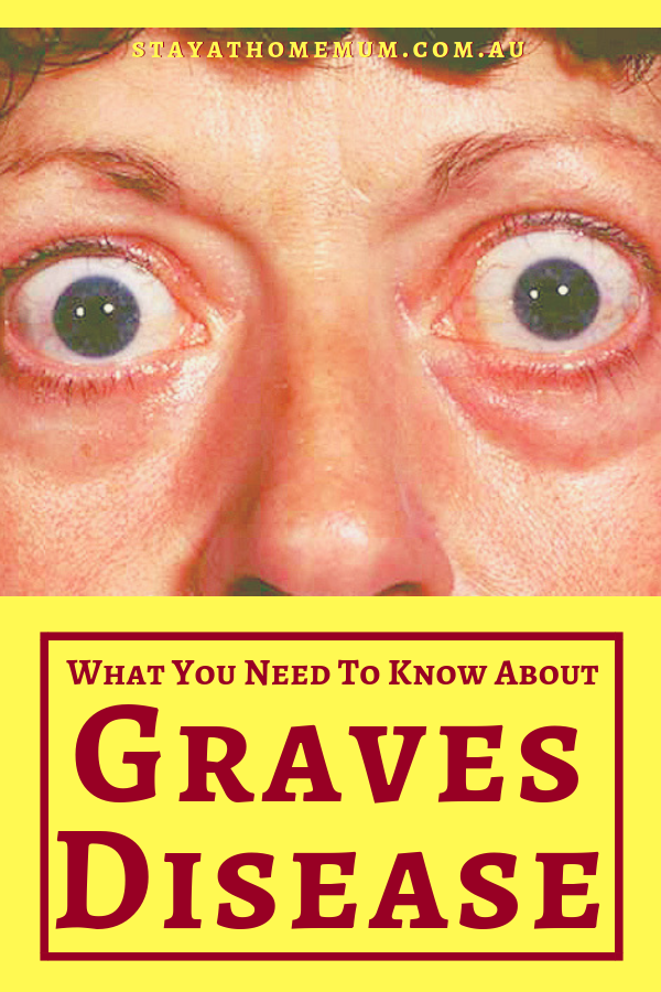 What You Need To Know About Graves Disease | Stay at Home Mum