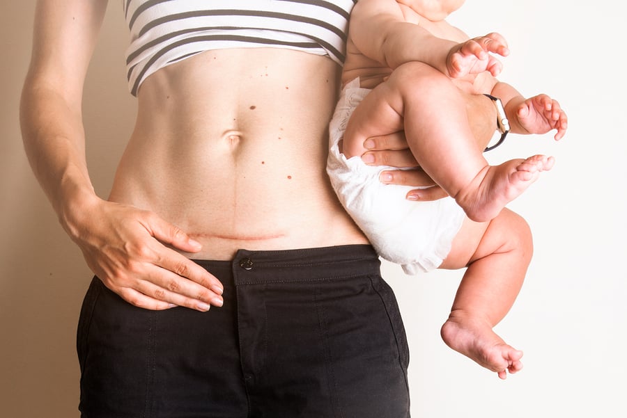 20 Women Share Their Postpartum Horror Stories I Stay at Home Mum