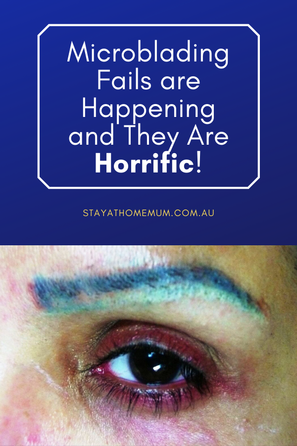 Microblading Fails are Happening and They Are Horrific! | Stay At Home Mum