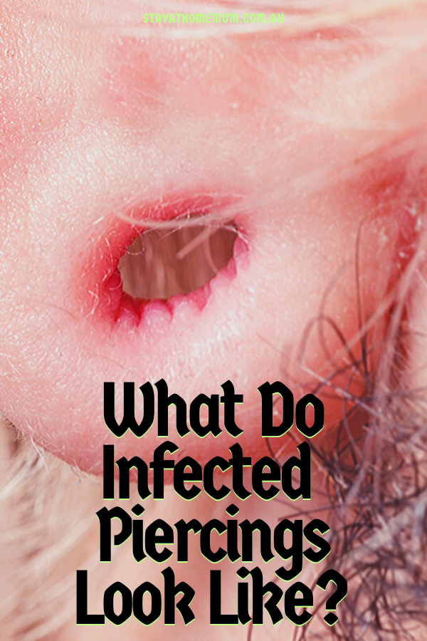 What Do Infected Piercings Look Like? | Stay at Home Mum