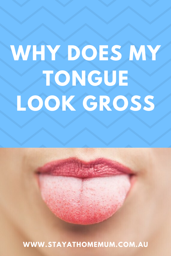 Why Does My Tongue Look Gross