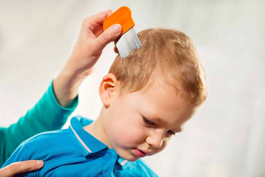 How to Treat Head Lice at Home