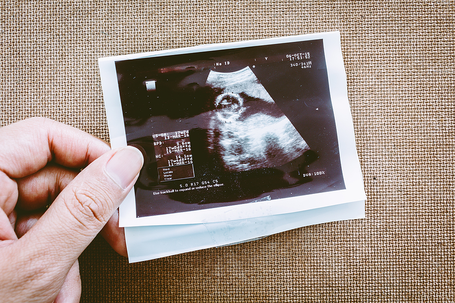 bigstock Photo Of An Ultrasound Sonogra 230225878 | Stay at Home Mum.com.au