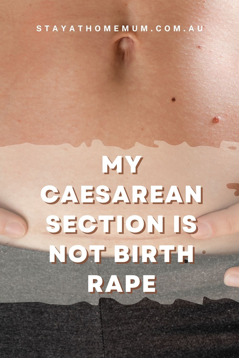 My Caesarean Section Is Not Birth Rape I Stay at Home Mum