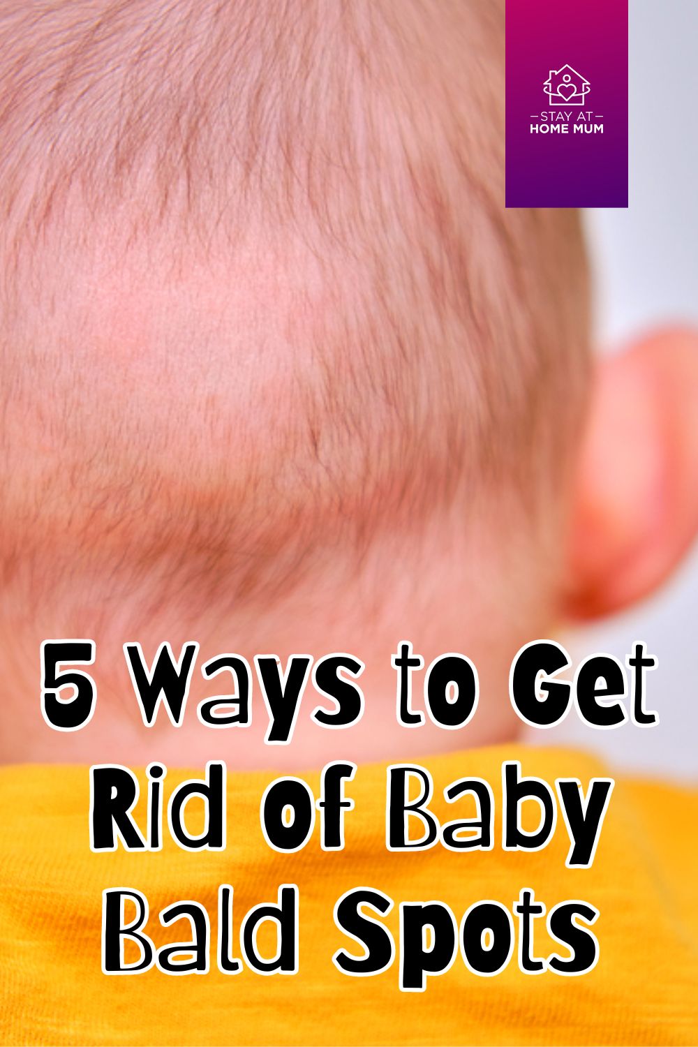 5 Ways to Get Rid of Baby Bald Spots Pinnable