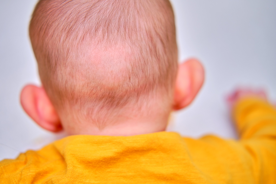 5 Ways to Get Rid of Baby Bald Spots - Stay at Home Mum